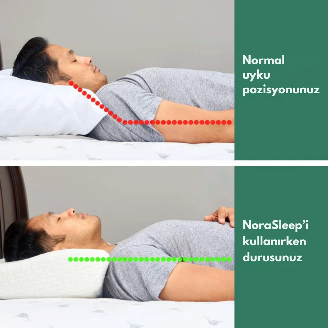 NoraSleep